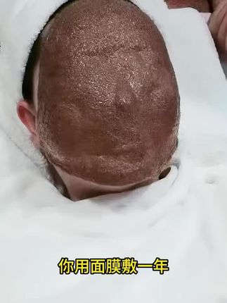 #儒意377美白祛斑霜#美国进口三重美白因子377+熊果苷+烟酰胺#美白祛斑补水保湿去黄提亮滋润肌底#抖音上买的好东西。