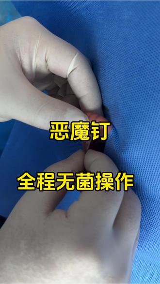 恶魔钉✖️2 #哈尔滨穿孔哪家好 #哈尔滨穿孔教学 #哈尔滨穿刺 #哈尔滨穿孔扛把子