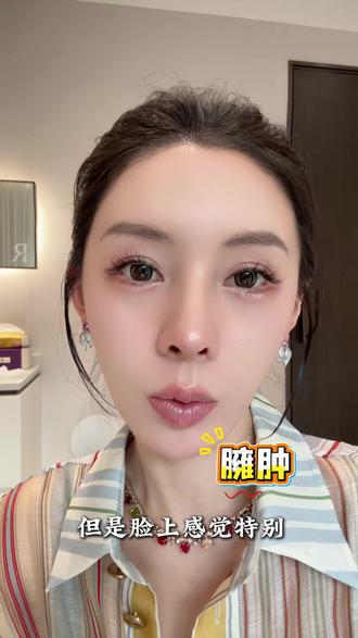 为什么你的面部发泡,臃肿?#变美分享 #馒化脸 #面部松弛 #抗衰