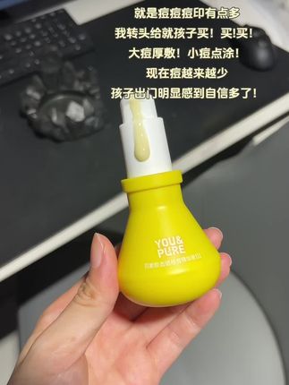 长痘反反复复的真的要试一下#羽素祛痘大灯泡#祛痘油痘肌