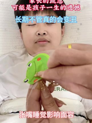 睡觉?家长一定重视起来,赶紧纠正他,长期不管真的会变丑,等牙齿凸就就来不及了#嘴呼吸会变丑#闭嘴贴