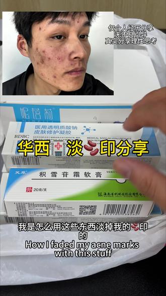 华西🏥淡🫘印跟练教程#痘痘 #痘印 #护肤 #痤疮 #日常vlog