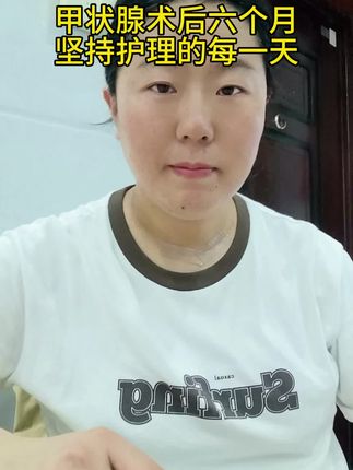 #甲状腺手术 #术后疤痕护理 术后六个月,第一次发现,脖子上那道淡红色的弧线会呼吸,也在渐渐发白,天热时它会发痒,下雨前它会发胀,深夜摸到它微凸的触感,像摸到了被折叠的时间。#上热门🔥 #dou上热门抖音 #疤痕贴的正确使用方法
