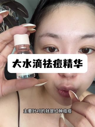 长痘痘千万别徒手挤! 在家里备一瓶这个会安心很多~#护肤好物 #祛痘精华 #油痘肌 #好皮肤