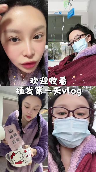 #不剃发植发第一天恢复,给大家分享日常养发饮食吧