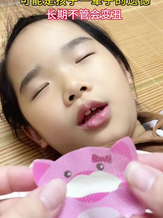 家长一定要注意⚠️#母婴好物 #闭嘴贴 #父母必看系列 #新手妈妈 #张嘴呼吸会变丑