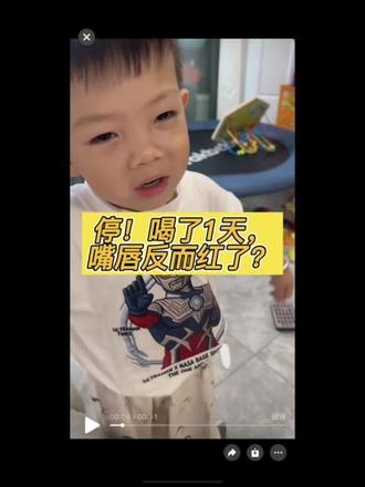 喝1天独脚金,舌苔白了但嘴唇更红了?懂的宝妈救救我! 喝1天独脚金水,舌苔白厚确实下去了,但娃的嘴唇红得像涂了口红😰 不是说独脚金消积清热吗?怎么“热”跑嘴唇上了?有没有懂中医的宝妈遇到过这种情况?明天要不要停掉?在线等,挺急的!🙏 #宝宝积食 #舌苔白厚 #独脚金 #育儿经验分享#宝宝脾胃