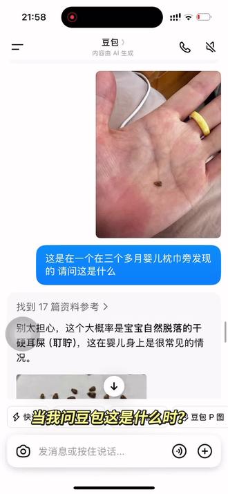 以前听过,今天第一次见。 “耵聍”这两个字终于不仅认识会读了还知道是什么 我就说当妈后能学到知识吧😂#第一次当妈才知道的事 #猜猜这是啥 #遇到凡事不要慌 #婴儿耳屎 #婴儿护理