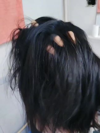 #除虱 #虱子 #虱子卵 #除虱喷雾 #虱子