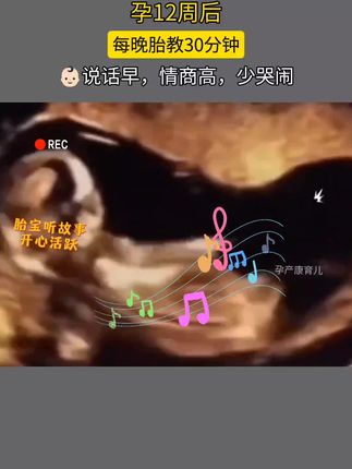 #胎教 #胎教真的有用 胎教做的好,说话早,哭闹少 情商高,更聪明,宝宝听声音好开心活跃,12周开始每晚胎教30分钟,爸爸妈妈要多和宝宝互动!出生后也可以当早教用#胎教故事书 #好物推荐🔥 #胎动