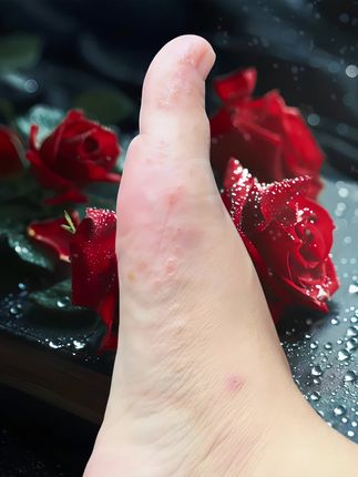 #万万没想到 终于不臭不痒了,我也成功上岸啦!#无处安放的小脚丫 #夏天该有的样子 #足部护理 #自信最美