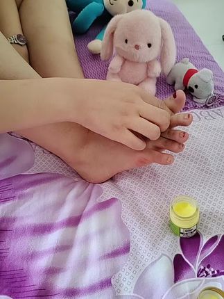 #脚丫子 #脚部护理 #真菌王@DOU+上热门 @生活服务热点中心