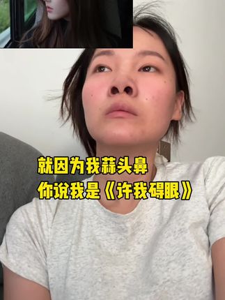 请大数据推给需要的姐妹!#鼻贴 #许我耀眼 #鼻贴测评 #蒜头鼻