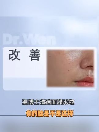 【新品推荐】维生素B5水杨酸面膜深层清洁毛孔保湿清爽控油春季修护#沧浪亭园林 #旅游景点的故事 #中山陵建筑风格 #乔沟头玉皇庙