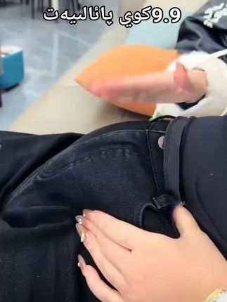 #女性脐膜