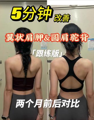 每日五分钟跟练 改善肩背
矫正翼状肩胛&圆肩驼背
#我们这一家 #一起野个好身材 #健身打卡 #创作者中心 #创作灵感