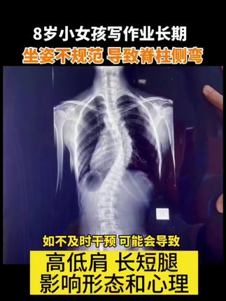 腰椎拉伸器瑜伽器锻炼脊柱脊椎背部伸展开背椎间盘舒缓腰疼#抖音推广 #居家锻炼 #含胸驼背矫正 #挺拔身姿 #自信