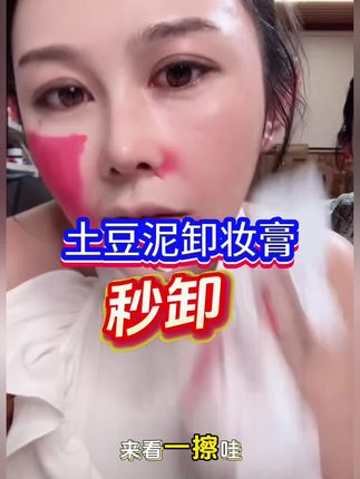 土豆泥卸妆膏,秒瓦解各种彩妆而且养肤!19块9是 重点! - 大罐!#土豆泥卸妆膏 #宇琳#宇琳院长 井寿 光寿光 #寿光宇琳#美肤养肤 #护肤分享 #亲测分享