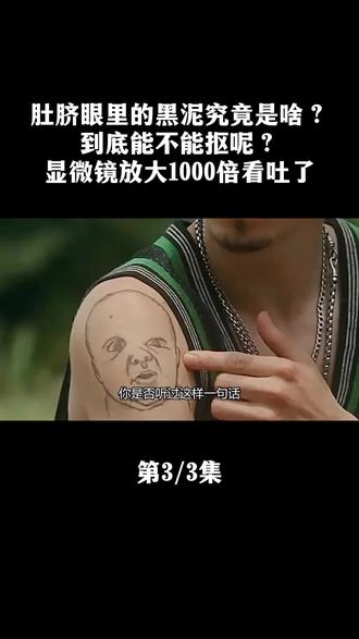 肚脐眼里的黑泥究竟是啥?到底能不能抠?显微镜放大1000倍看吐了 #肚脐眼 #脐泥 #黑泥 #涨知识 #科普