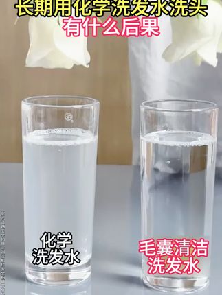 因为专业值得信赖。头皮痒,头屑多,头上长小疙瘩,头发油腻的朋友,我力荐你用用这款毛囊清洁洗发水