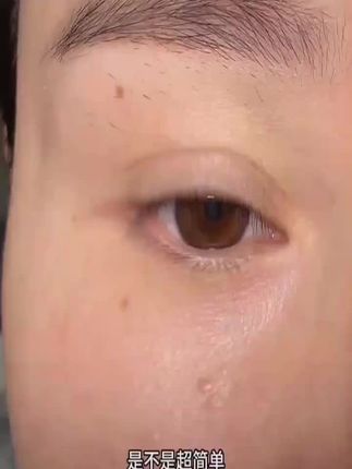 双眼皮下垂变形的姐妹,这个蕾丝双眼皮贴你就用吧,一用一个不吱声,主打的就是一局部定位,想调整哪里贴哪里~