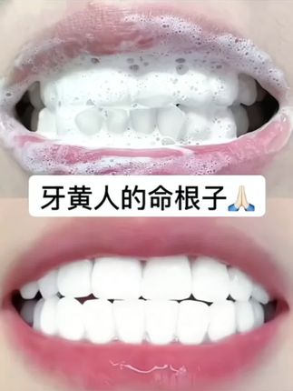 不管你是嘴巴不好闻,还是牙齿黑黄,都可以试试这款#宫教授亮白口气清新牙膏
