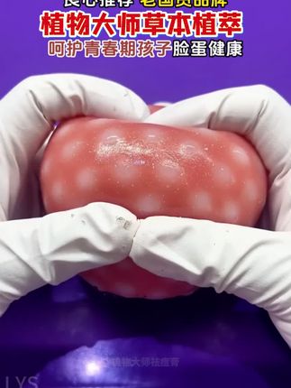 植物大师祛痘膏,早晚涂2次,青春痘、上火痘、姨妈痘都能用
