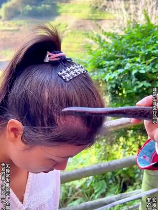就是这款防脱护发洗发水,坚持下去,给你头皮头发不一样的体验!#养发补发#防脱固发洗发水