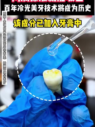 不管你是嘴巴不好闻,还是牙齿黑黄,都可以试试这款#宫教授亮白口气清新牙膏