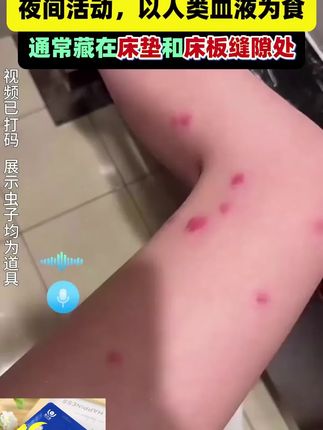 气候多变,潮湿闷热螨虫就容易滋生,家里每天接触皮肤又不好清理的床垫、衣柜沙发,奉劝都用除螨包,放心、安心