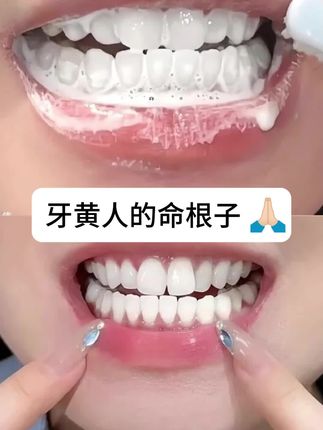 不是…这么宣传真的没人管管吗!#Dr.ML美白牙膏 #谁懂一口好牙的含金量 #就要水灵灵地去班味儿