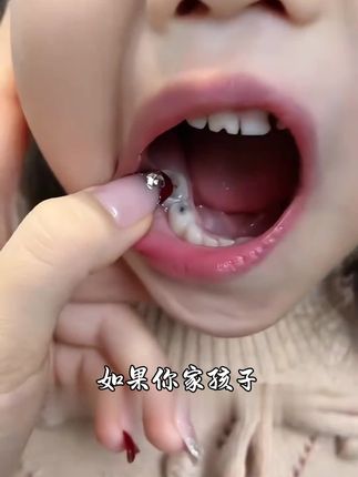 赶紧囤!#优伢宝贝抗糖酸防蛀牙膏!能防蛀、抗酸蚀、清新口气提升牙釉质硬度,新品冲量#儿童牙膏 #宝宝刷牙#儿童牙膏