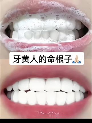 牙齿素颜霜!牙越黄的人用效果越惊艳,嘴巴还是香香的!色修牙膏