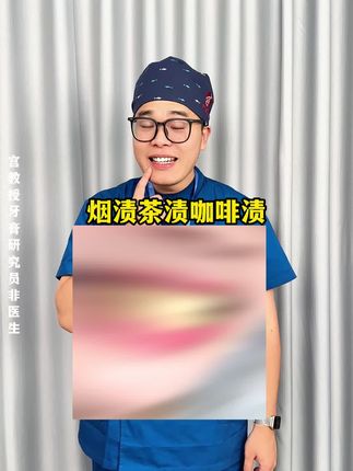 逆袭白牙真的很简单!爱喝咖啡有黄牙渍的不要错过它!#宫教授美白牙膏 #一花一个新世界