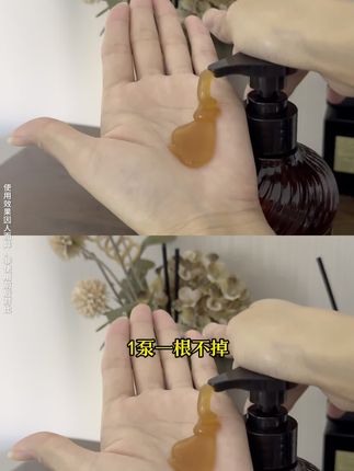 熬夜掉发头油头皮屑多就用高缇雅